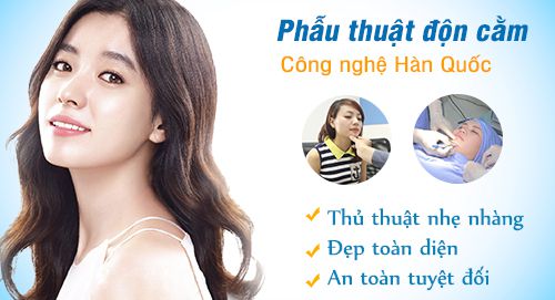 3-tieu-chi-quan-trong-de-lua-chon-dich-vu-tham-don-cam