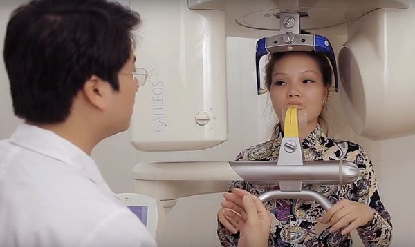 Độn cằm tự thân Kangnam 3