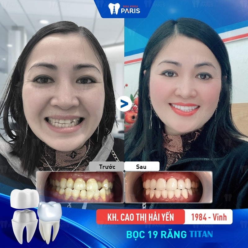 Bác sĩ tư vấn nhiệt tình, đưa ra phác đồ phù hợp