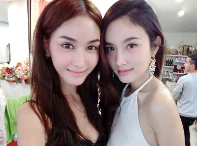 Sở hữu cằm V-line nhờ độn cằm: Đẹp chuẩn đúng xu hướng